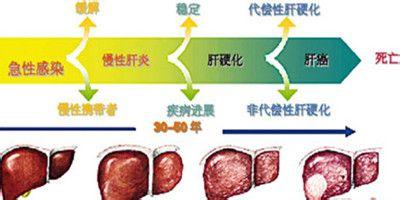 綠色的食物對肝癌的治療有哪些作用？