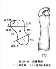 腕部骨折中的隱形殺手