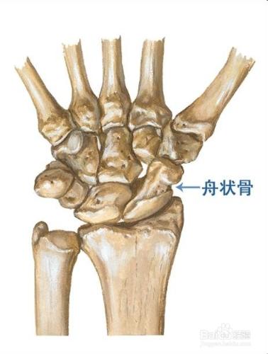 腕部骨折中的隱形殺手