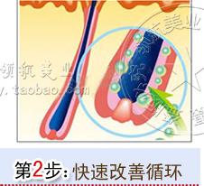 女孩子掉頭髮怎麼辦