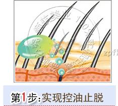 女孩子掉頭髮怎麼辦