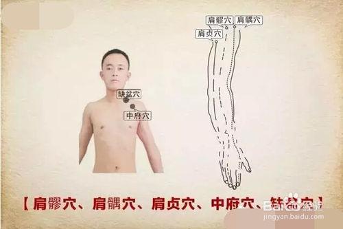 肩關節損傷、肩膀痠痛的中醫穴位療法