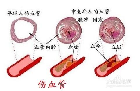 霧霾帶來的危害