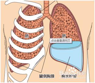 肺癌晚期症狀