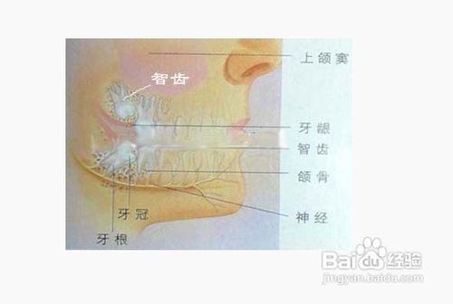 長智齒的相關事項