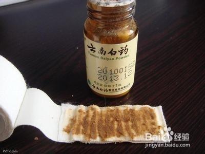 冬季凍瘡怎麼治更有效