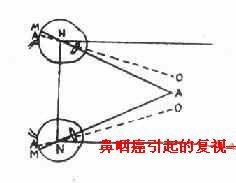 鼻咽癌的臨床表現有哪些？