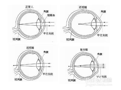 有效預防眼近視