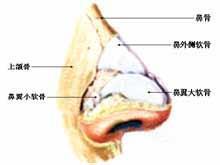 鼻骨骨折復位療法