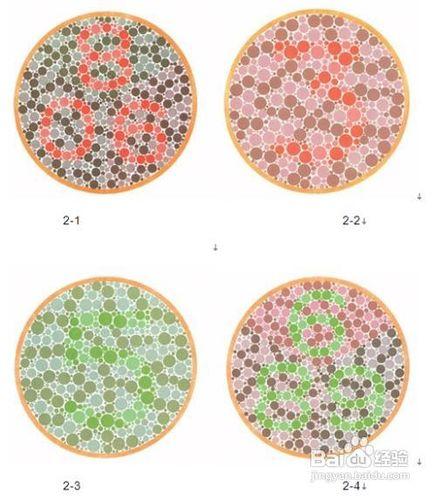 教你判斷父母是否患有白內障的檢驗方法