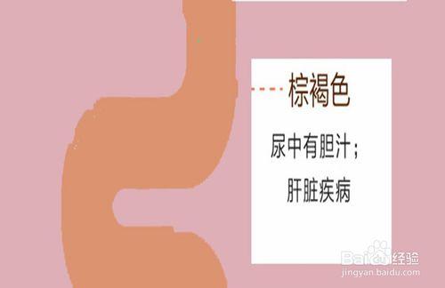 一圖看懂如何通過小便顏色判斷自己的健康狀況