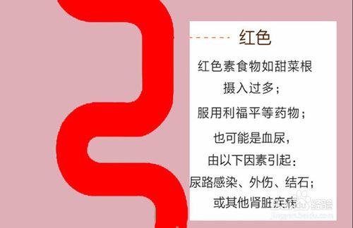 一圖看懂如何通過小便顏色判斷自己的健康狀況