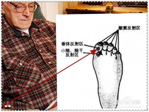 怎樣預防老年痴呆症？