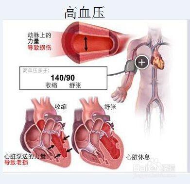 高血壓患者應該常吃哪些蔬菜？