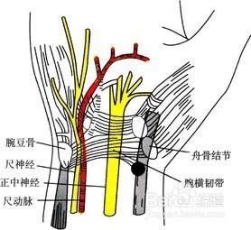 腱鞘炎怎麼治療