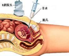 高齡孕婦需要做怎樣的產前準備？