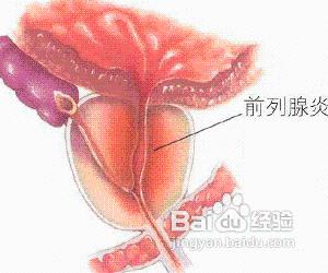 熱淋清顆粒可與哪些藥物聯合使用？