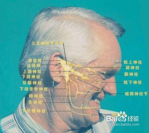 三叉神經痛怎麼治療有效