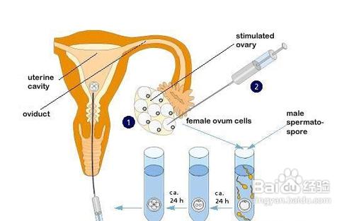 做試管嬰兒的條件