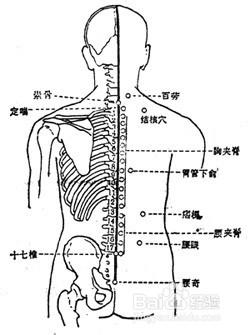 鍼灸治療腰椎間盤突出的穴位選擇