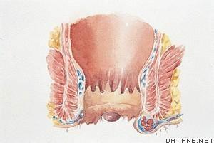 帶你認識常見病：[12]痔