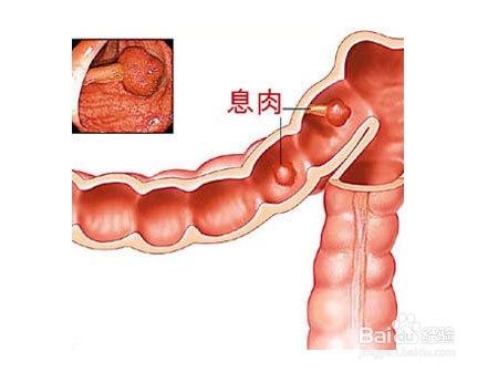 口臭是什麼原因造成的