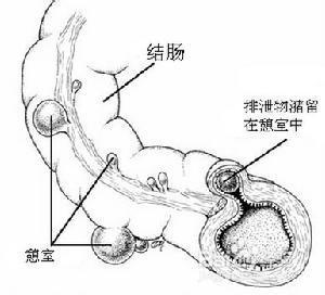 口臭是什麼原因造成的