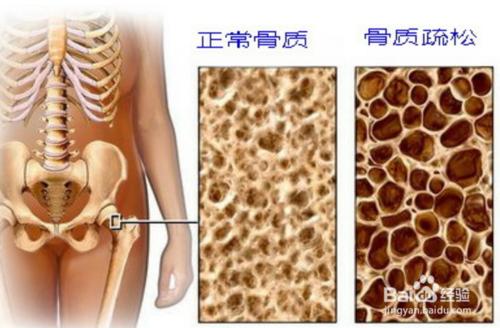 腰痛的一些原因