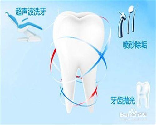 去除牙結石有什麼好的方法？