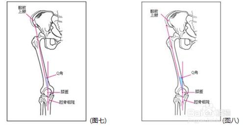 膝關節痛是怎麼回事