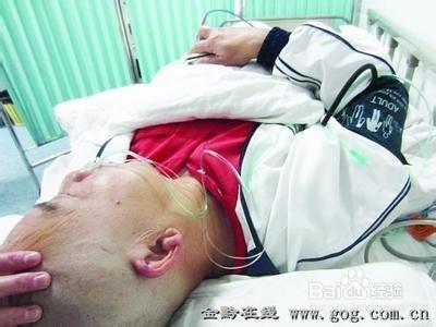 戶外急救知識手冊：[5]被馬蜂蜇怎麼辦