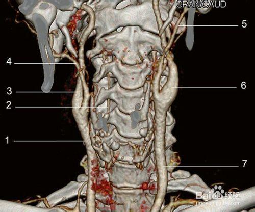 頸動脈血管造影圖譜：[1]正常頸動脈血管造影