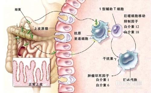 天冷吃火鍋你得\\\&quot;火鍋病\\\&quot;了嗎