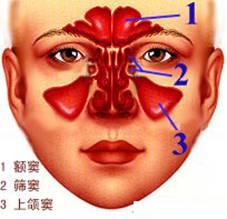鼻竇炎怎麼治療