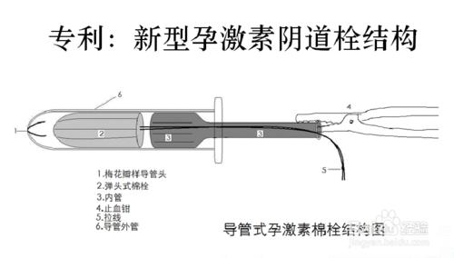 導管式羊同期發情棉栓的使用方法