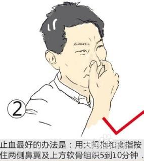 鼻出血常見問答針對民營醫院諮詢