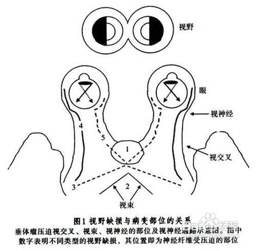 泌乳素偏高與月經不調的關係