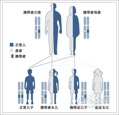 少年白髮的原因