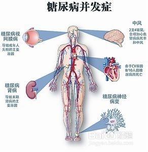 糖尿病為什麼選擇負離子