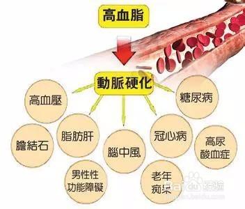 3大誤區，高血脂症患者要小心