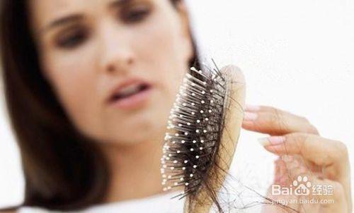 如何治療脂溢性脫髮？
