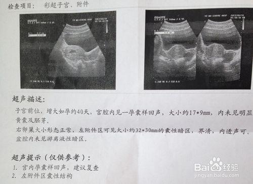 順產應該注意什麼？