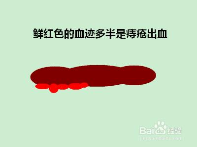 怎樣根據大便及早發現健康隱患