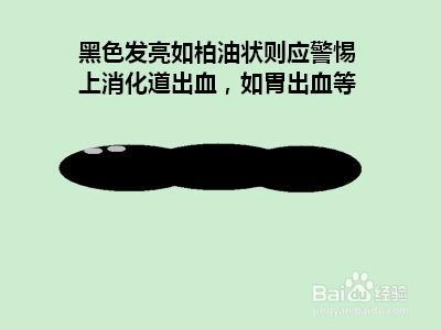 怎樣根據大便及早發現健康隱患