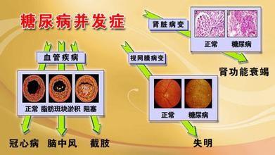 糖尿病患者該怎麼吃？