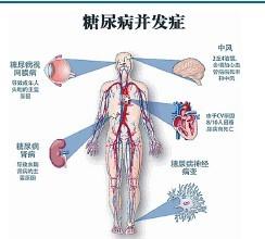 糖尿病患者該怎麼吃？