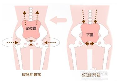 產後恥骨痛、大腿痛，骨盆帶有用嗎？要怎麼使用