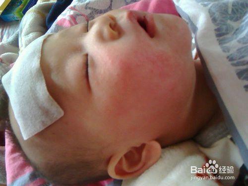 嬰幼兒出現高燒不退，可能是嬰兒急疹