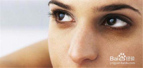 黑眼圈要對症治療後再進行美容才有效果