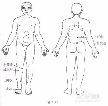 腎結石的砭石療法~80%的人不知道